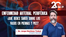 Enfermedad Arterial Periférica: ¿Qué debes saber sobre los vasos en piernas y pies? - #ExclusivoMSP