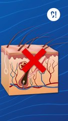 L'épilation définitive, une pratique dangereuse ?