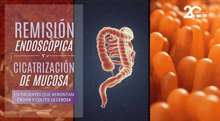 Remisión endoscópica y cicatrización de mucosa en pacientes que afrontan Crohn y colitis ulcerosa