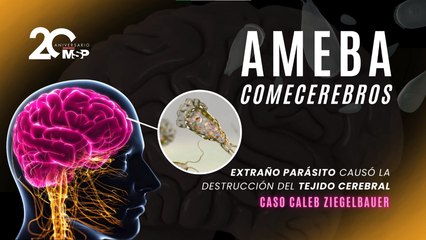 Ameba comecerebros: extraño parásito causó la destrucción del tejido cerebral - Caso Caleb Ziegelbauer
