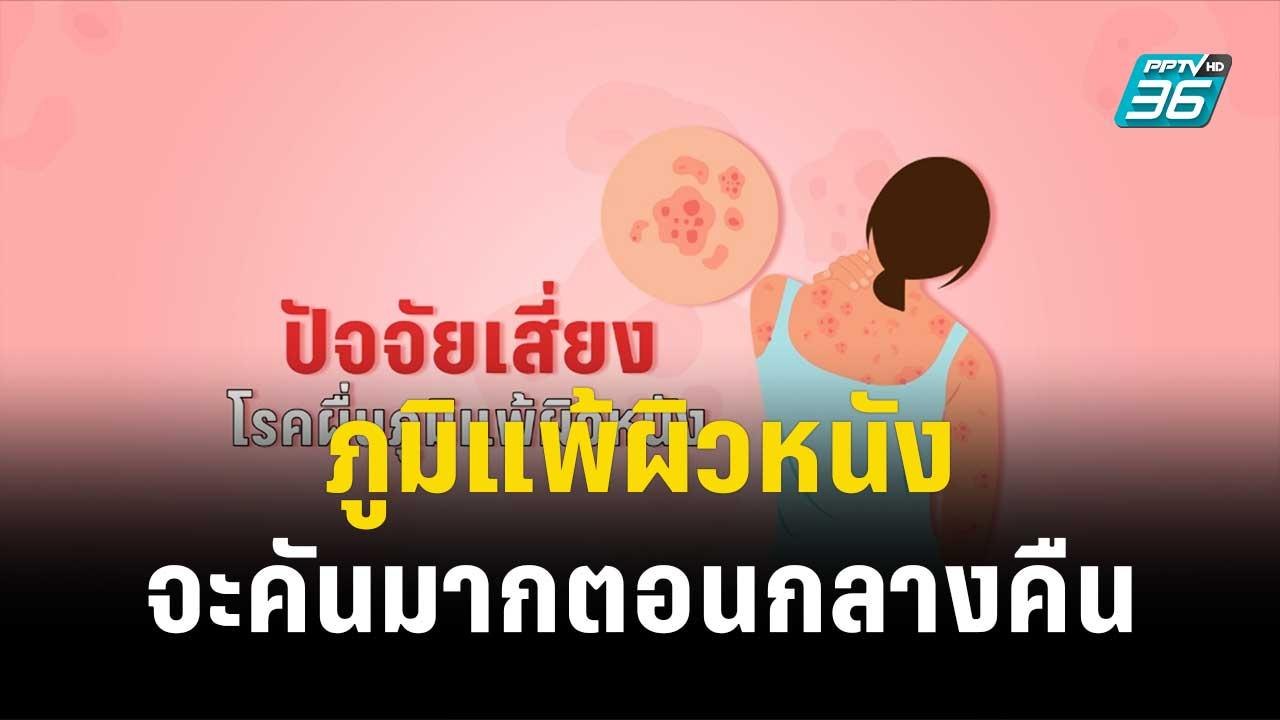 1 นาทีสุขภาพดี กับ BDMS ภูมิแพ้ผิวหนังจะคันมากต...