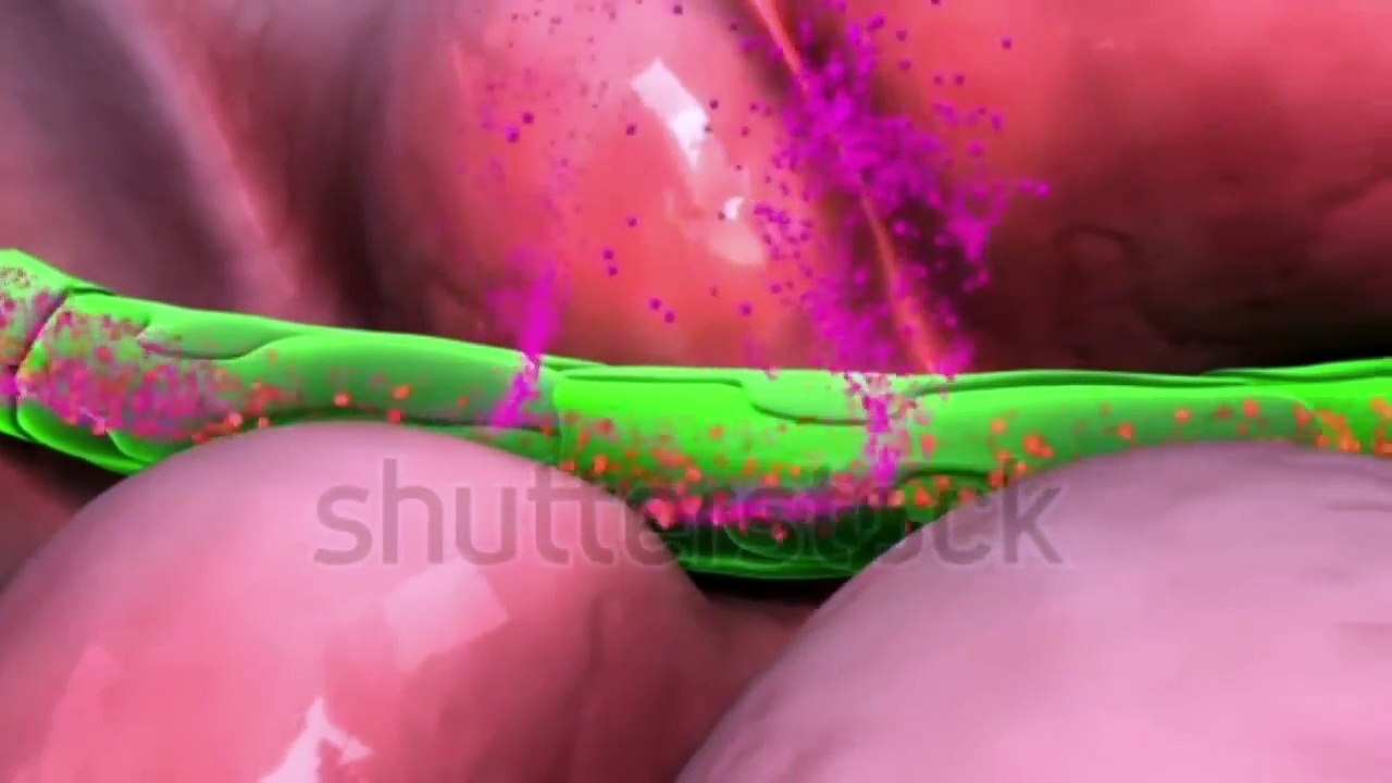 How To Get Rid Of Cellulite On Thighs & Buttocks