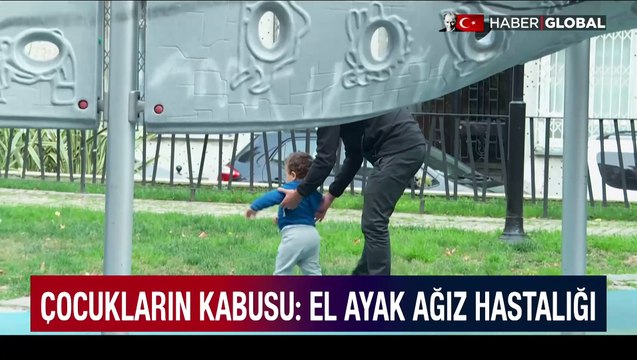 Çocukların kabusu: El ayak ağız hastalığı!