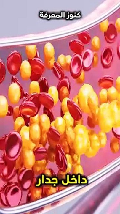 يمنع انسداد وضيق الشّرايين