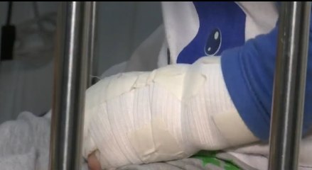 Ya van 640 personas quemadas con pólvora en diciembre