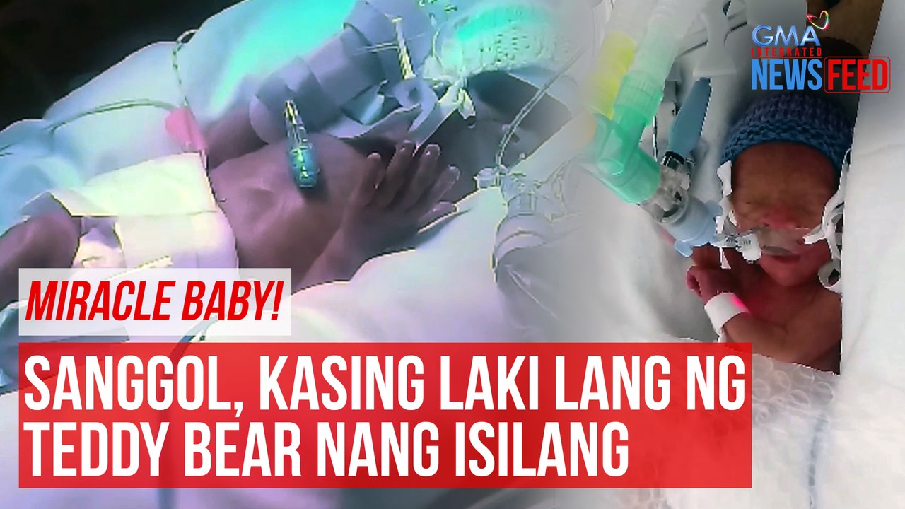 MIRACLE BABY!   Sanggol, kasing laki lang ng teddy bear nang isilang | GMA Integrated Newsfeed