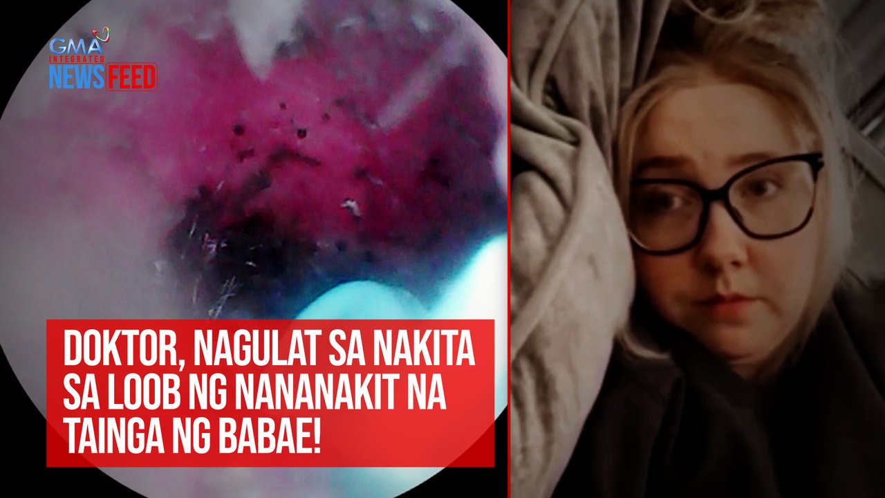 Doktor, nagulat sa nakita sa loob ng nananakit na tainga ng babae! | GMA Integrated Newsfeed