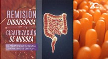 Remisión endoscópica y cicatrización de mucosa en pacientes que afrontan Crohn y Colitis ulcerosa - #MSP