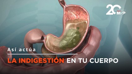 ¿Por qué sufrimos de indigestión luego de comer mucho? - #ExclusivoMSP
