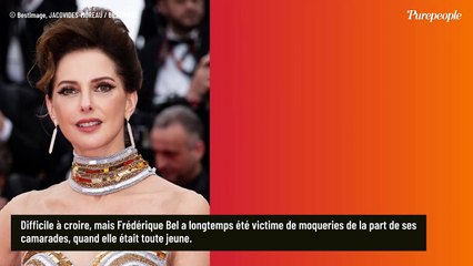 "Je ne voyais que d'un oeil..." : Frédérique Bel, son handicap apparu à l'adolescence, un surnom cruel donné par ses camarades