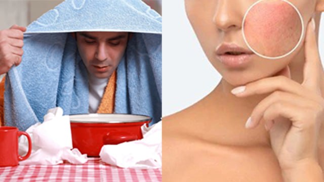 ज्यादा भाप लेने से क्या होता है | Jyada Steam Lene Se Kya Hota Hai | Boldsky