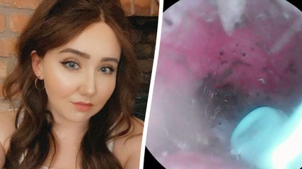 "I pulled a spider's nest out of my ear - it was like something from Stranger Things"