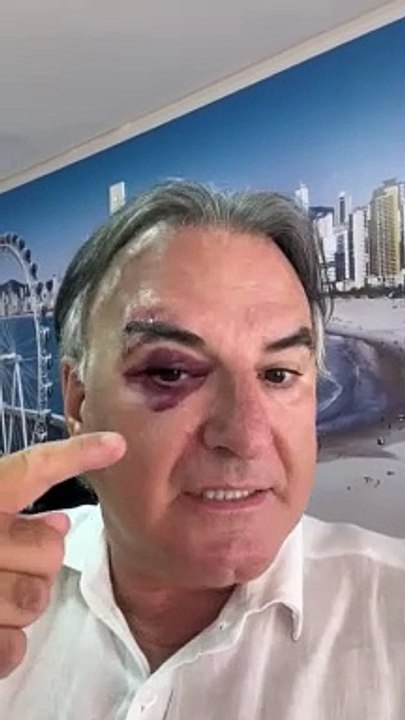 Dupla é presa após agressão e roubo a empresário em Balneário Camboriú