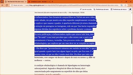 Tata Estaniecki fala sobre rompimento de vaso no olho; entenda o que é o hiposfagma e se há riscos
