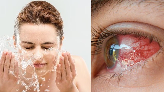 सर्दी में आंख को गर्म पानी से धोना चाहिए | Is It Good To Wash Eyes With Warm Water|Boldsky