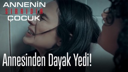 Annesinden Dayak Yedi!