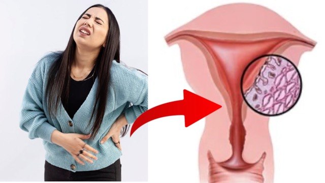 Period Me Uterus Me Dard Hona | पीरियड में बच्चेदानी में दर्द होने का कारण | Boldsky