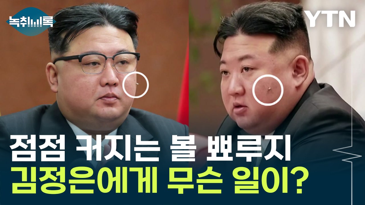 北 김정은, 건강에 문제? 점점 커지는 볼 뾰루지에 '주목' [Y녹취록] / YTN