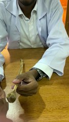 Fibula, its side determination & complete bony features