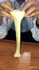 Tibia | shin bone, its side determination & complete bony features.