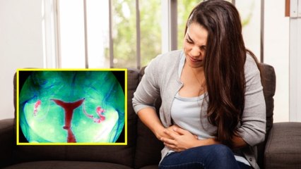 Fallopian Tube Blockage Symptoms In Hindi | फेलोपियन ट्यूब बंद होने के लक्षण | Boldsky