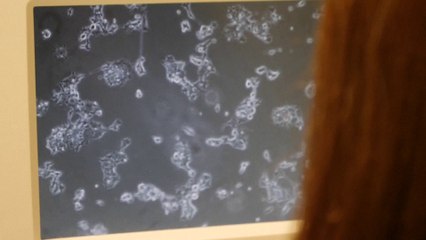 الأشخاص المصابين بالالتهابات الفيروسية أكثر عرضة لـ"ألزهايمر"