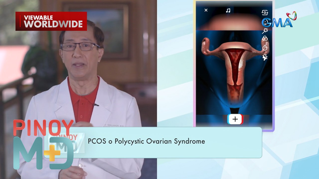 Ano ang dahilan sa pagkakaroon ng PCOS o Polycystic Ovarian Syndrome ...