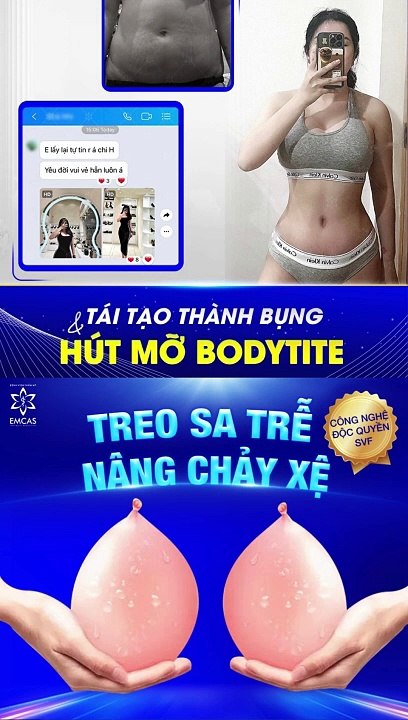 Lời Đồn Phẫu Thuật Tại EMCAS Gây Chết Người Có Thật Không