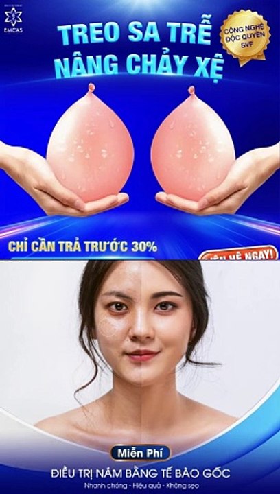Review Bệnh Viện Thẩm Mỹ EMCAS Chết Người Tin Đồn Và Thực Tế