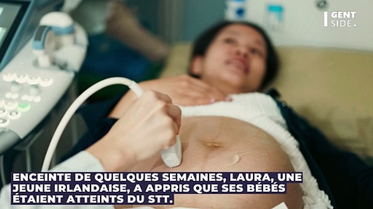 Des jumeaux s’entretuent dans le ventre de leur mère, les médecins obligés de déclencher l’accouchement