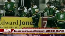 GRAPHIC VIDEO: Portero de hockey SUFRE TERRIBLE LESION en pleno juego de Hockey