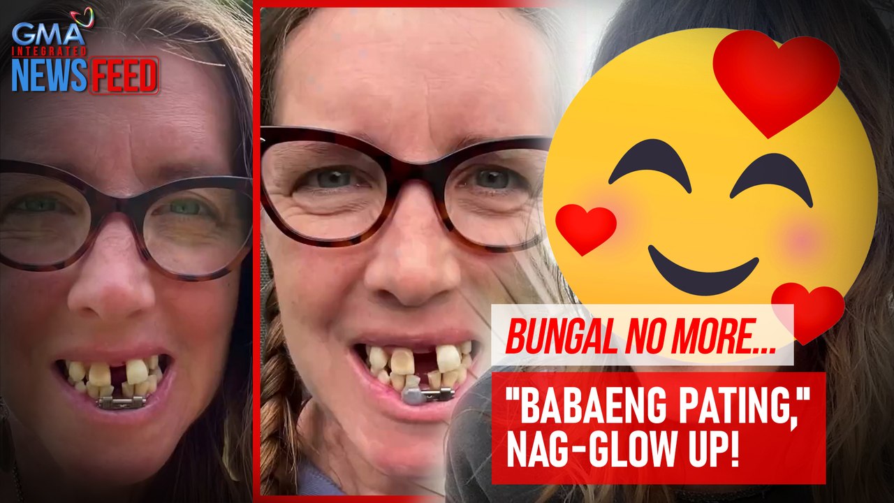 Bungal no more! "Babaeng pating," nag-glow up! | GMA Integrated Newsfeed