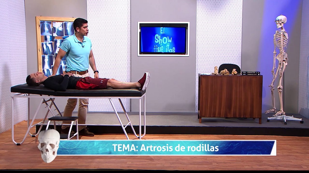 6 ARTROSIS DE RODILLA 3_1