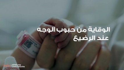 الوقاية من حبوب الوجه عند الرضيع