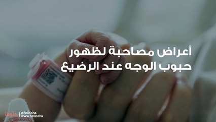 أعراض مصاحبة لظهور حبوب الوجه عند الرضيع
