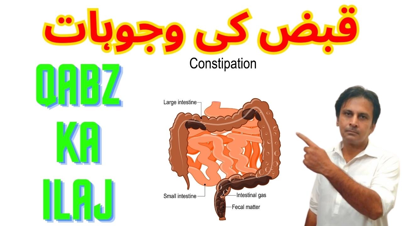 Qabz ki wajohat Qabz ka laj Qabj ka ilaj kaise karain Arshads