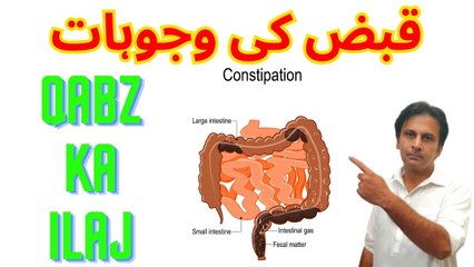Qabz ki wajohat | Qabz ka laj | Qabj ka ilaj kaise karain | Arshads kitchen