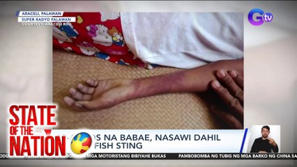 State of the Nation Part 2: Jellyfish sting; Pertussis Outbreak sa Iloilo City ; atbp.