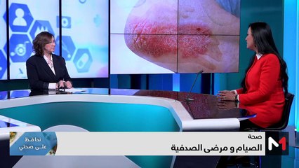الصيام ومرضى الصدفية - 25/03/2024