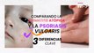 ¿Cómo diferenciar la dermatitis atópica y la psoriasis vulgaris? - #ExclusivoMSP