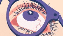 Les secrets pour préserver la santé de vos yeux de façon naturelle.
