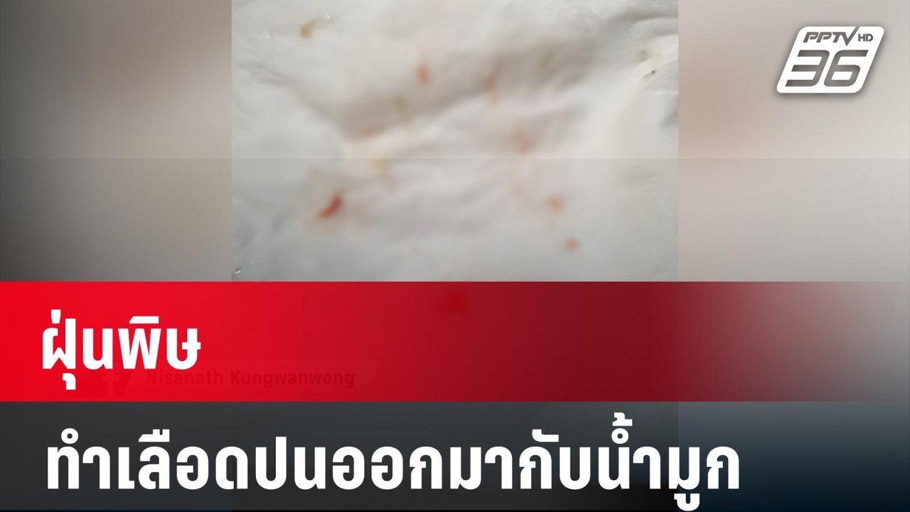 ฝุ่นพิษ ทำเลือดปนออกมากับน้ำมูก  | เที่ยงทันข่า...