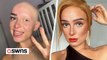 Woman with alopecia gets ready for work the night before - sleeping with her hair and eyebrows done
