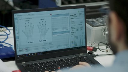 Cinq nouvelles du cerveau