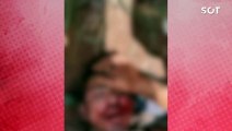 Homem ferido se desculpa por crimes em vídeo viral nas redes sociais