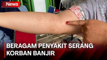 Korban Banjir di Muratara Sumsel Terserang Penyakit Gatal-Gatal