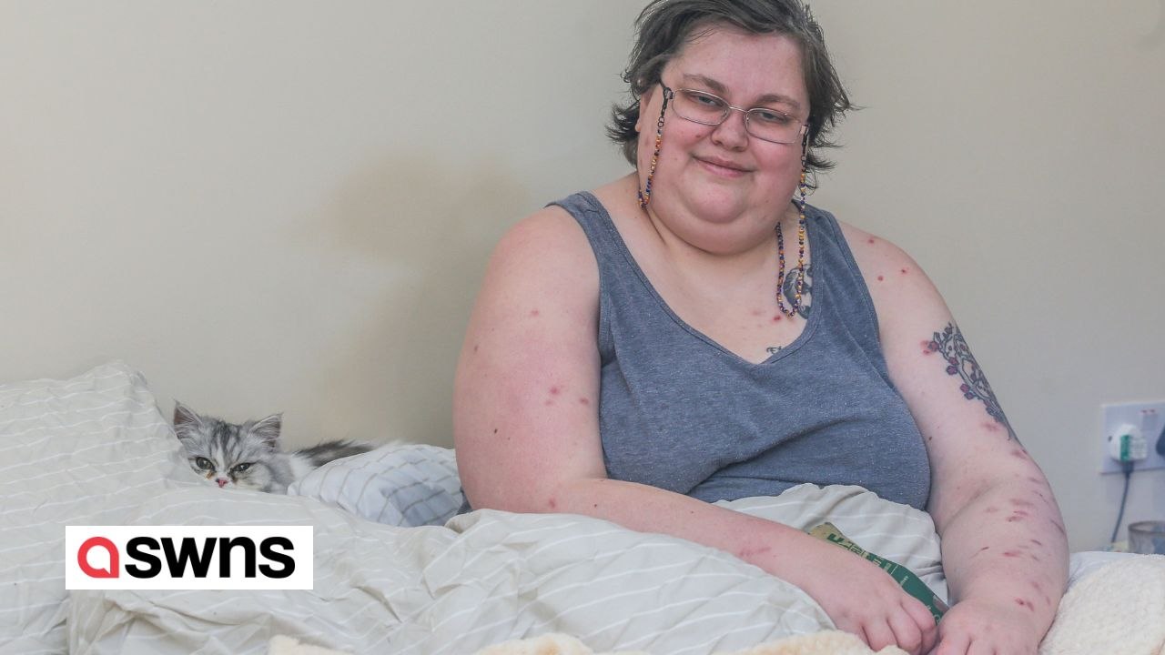 "I have epilepsy - my clever cat can detect my seizures eight hours before they happen"