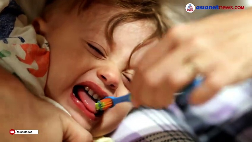 കുഞ്ഞിപ്പല്ലുകളുടെ ആരോഗ്യം സംരക്ഷിക്കാൻ ഇക്കാര്യങ്ങൾ ശ്രദ്ധിക്കൂ...