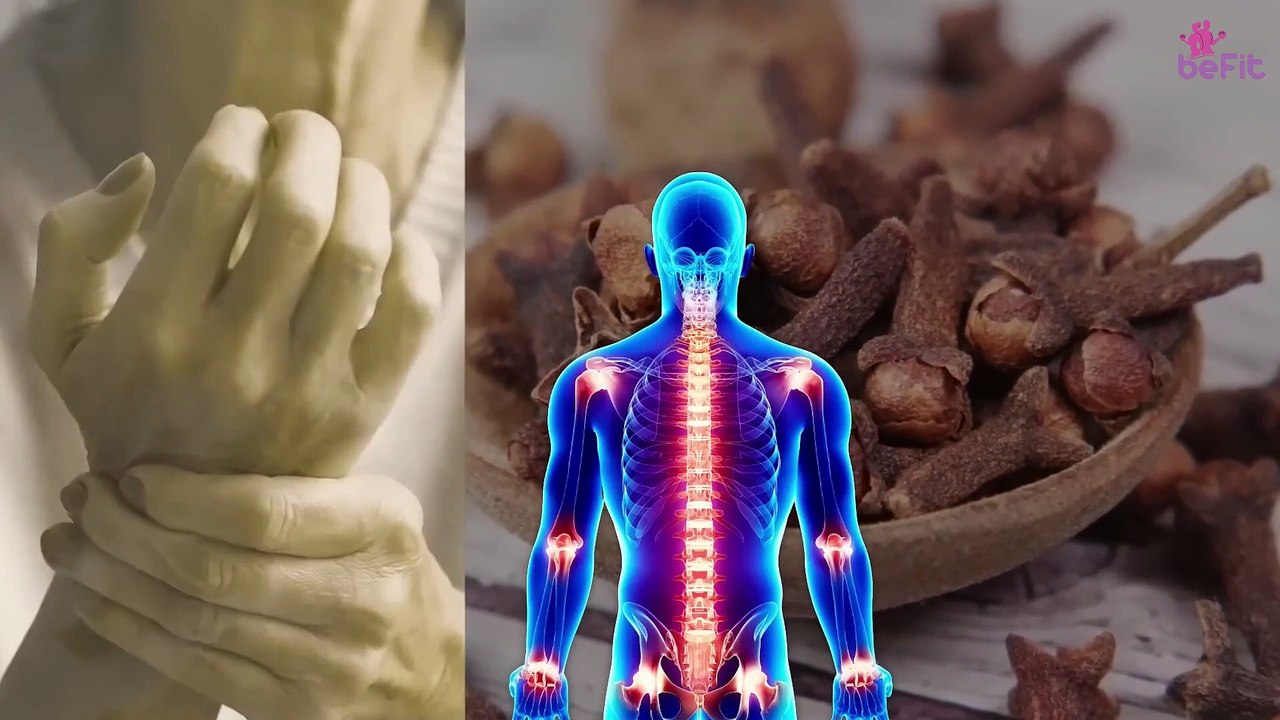 Health Benefits of Cloves: Just 2 Cloves Every Day and Results Will Surprise You!
