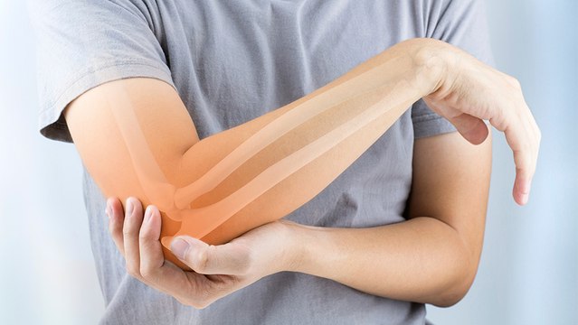 bd-osteoporosis-causas-sintomas-prevencion-y-posibles-tratamientos-150124